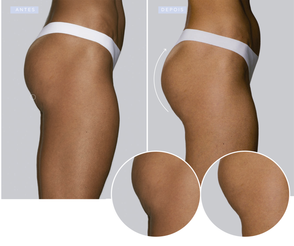 corpo6.png